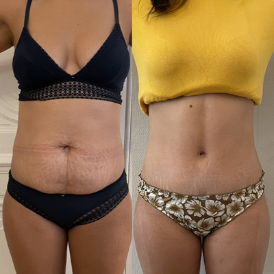 From bloated to brilliant in 30 days ✨